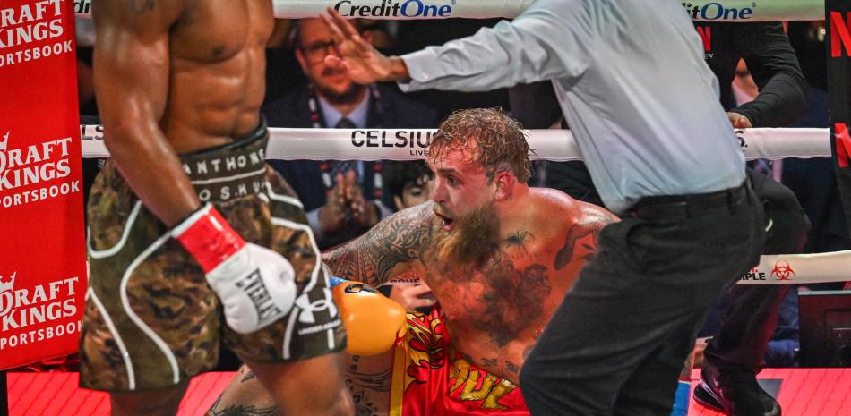 Jake Paul operado de la mandíbula tras pelea con Anthony Joshua